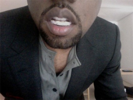 Los dientes de Kanye West